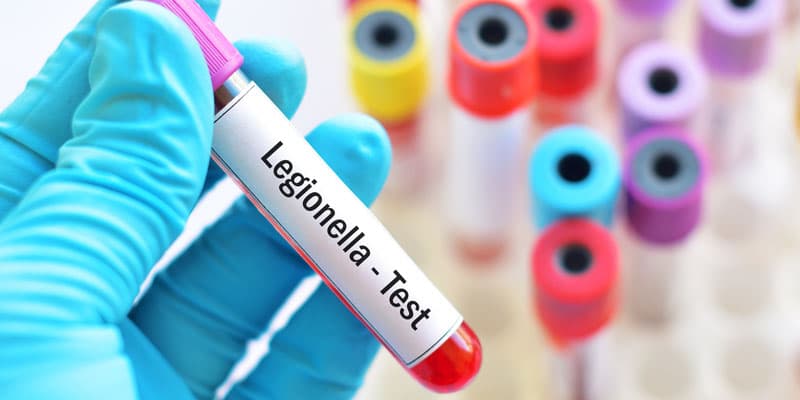 Legionela